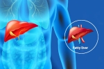 Fatty Liver Disease News news, Fatty Liver Disease News health, body organs that can be affected by fatty liver disease, Fatty liver disease news