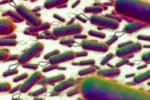 E.coli Outbreak UK, E.coli Outbreak breaking, all about e coli outbreak in the united kingdom, Kidney failure