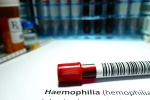 Hemophilia among men, Hemophilia doctors, why are men likely to develop hemophilia, Doctors