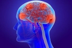 post covid complications, post covid complications, coronavirus can cause long term loss of brain tissue, Fda