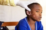 Monkeypox Outbreak cases in India, Monkeypox, is monkeypox outbreak coming to india, Monkey