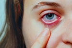 Conjunctivitis videos, Conjunctivitis cases, special measures to prevent conjunctivitis, Conjunctivitis