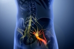 Sciatica nerve, Help yourself on Sciatica, help yourself on sciatica, Natural remedies